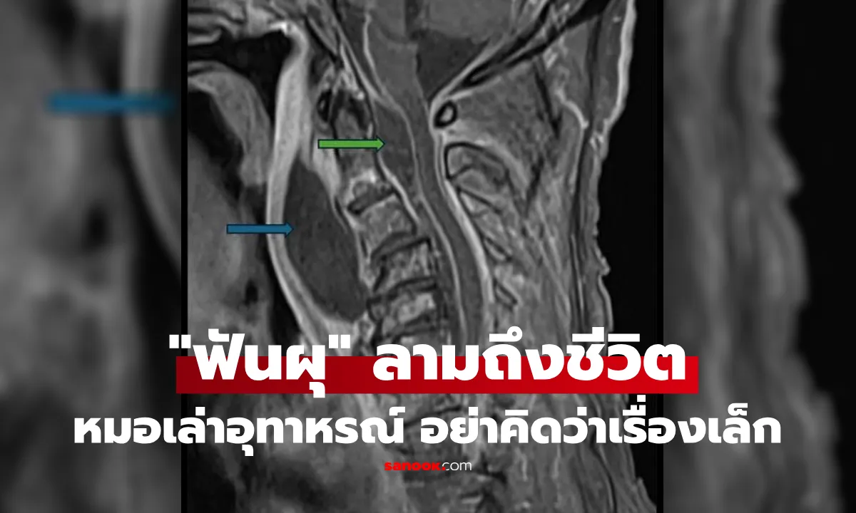 Post by pimol chaikul62