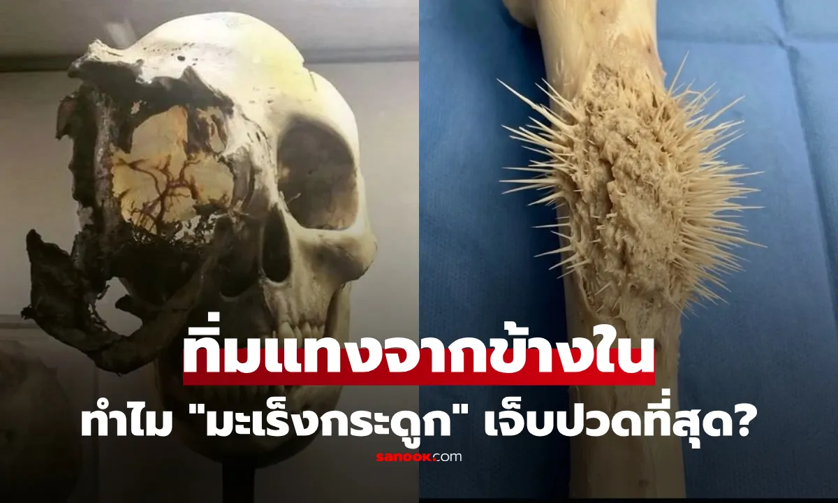 Post by pimol rakthai36