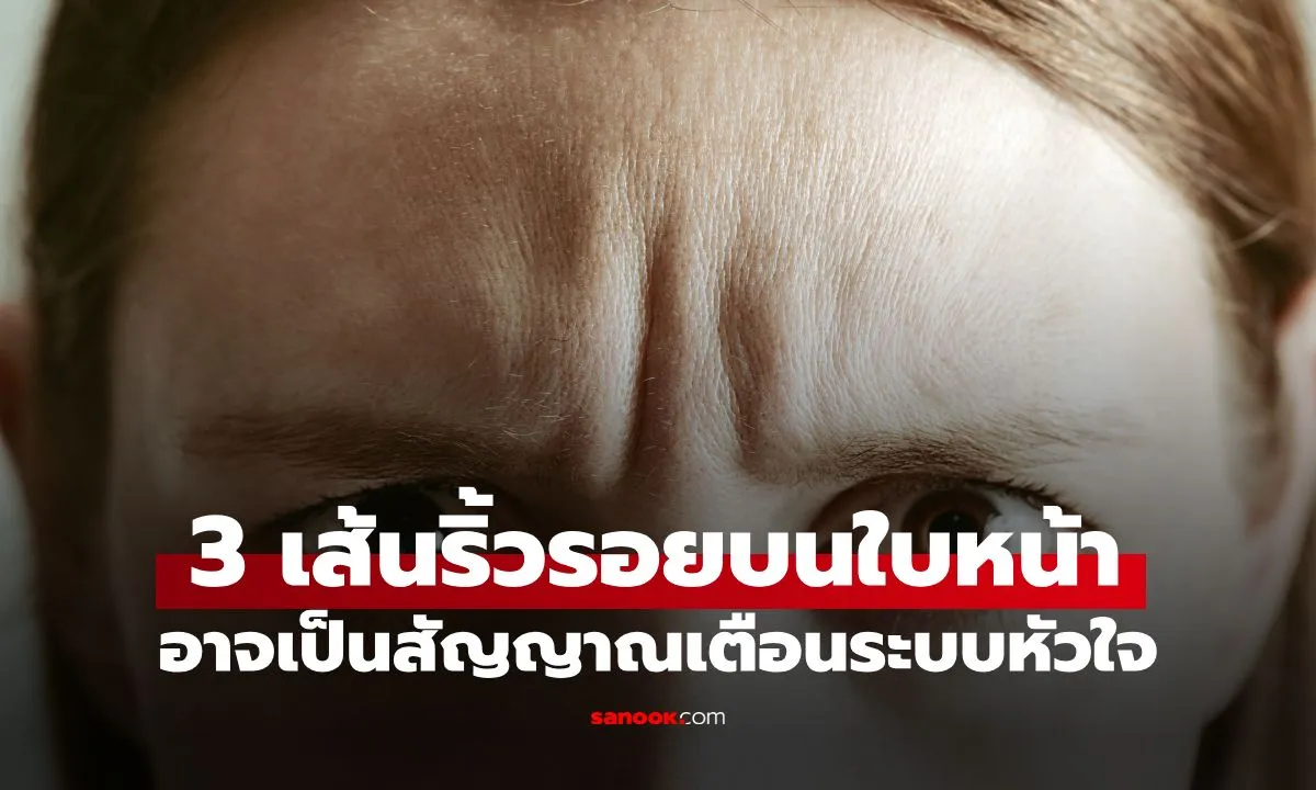 Post by Non ณัฐวุฒิ