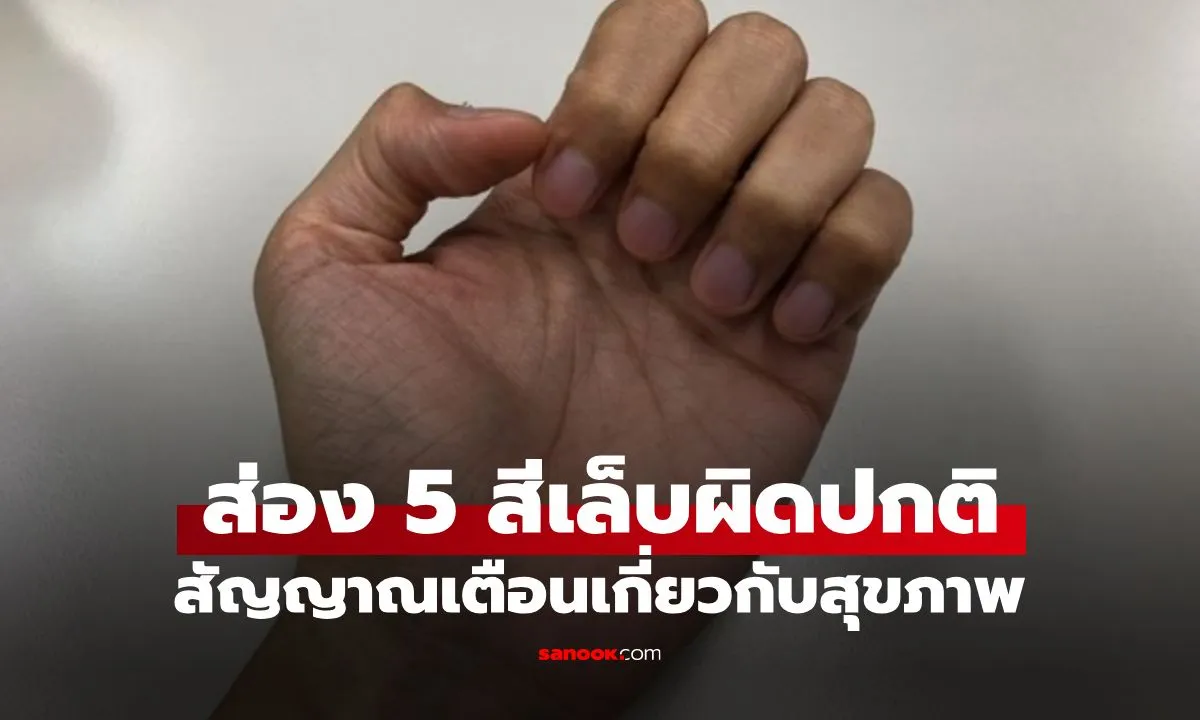 Post by sunisa meechai72