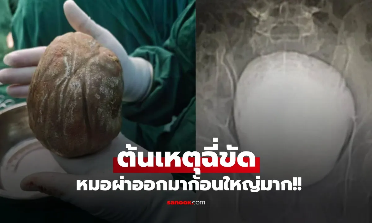 Post by Non ศุภชัย